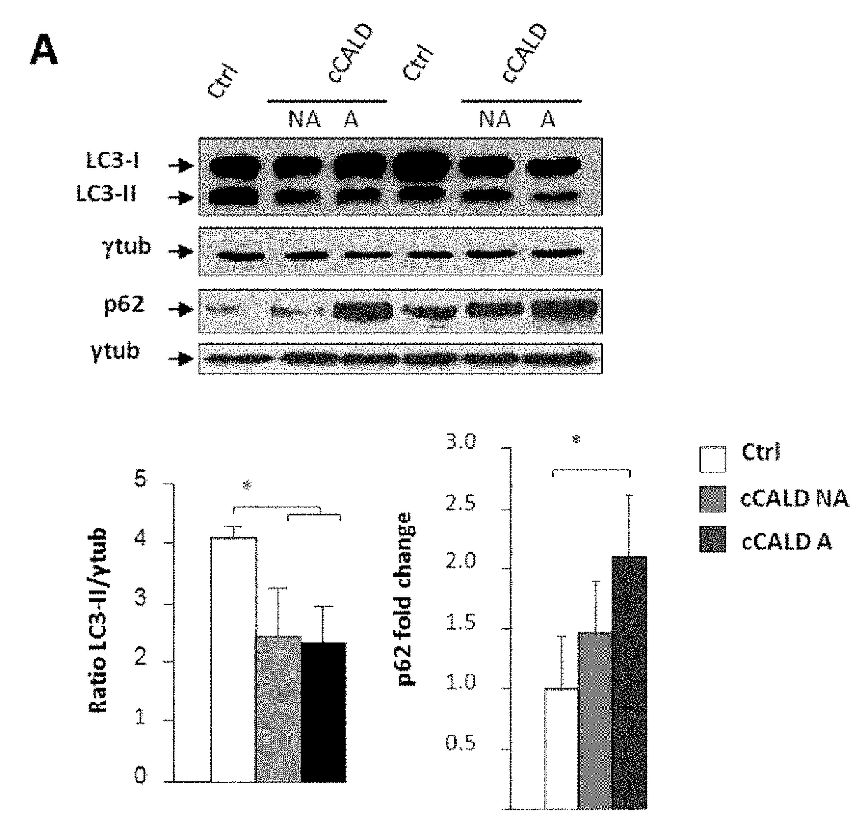 Specific mtor inhibitors in the treatment of x-linked adrenoleukodystrophy