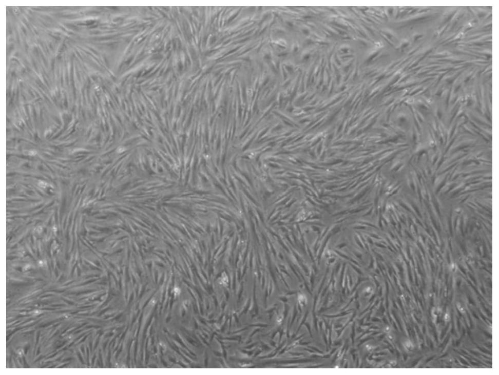 A preparation method and recovery method of parietal decidual mesenchymal stem cells