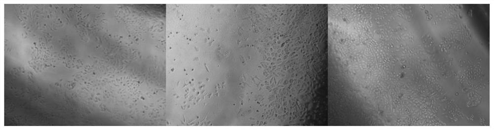 A preparation method and recovery method of parietal decidual mesenchymal stem cells