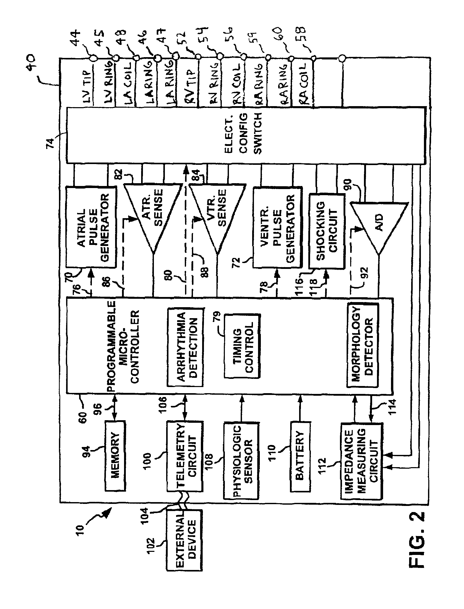 Anti-tachycardia pacing methods and devices