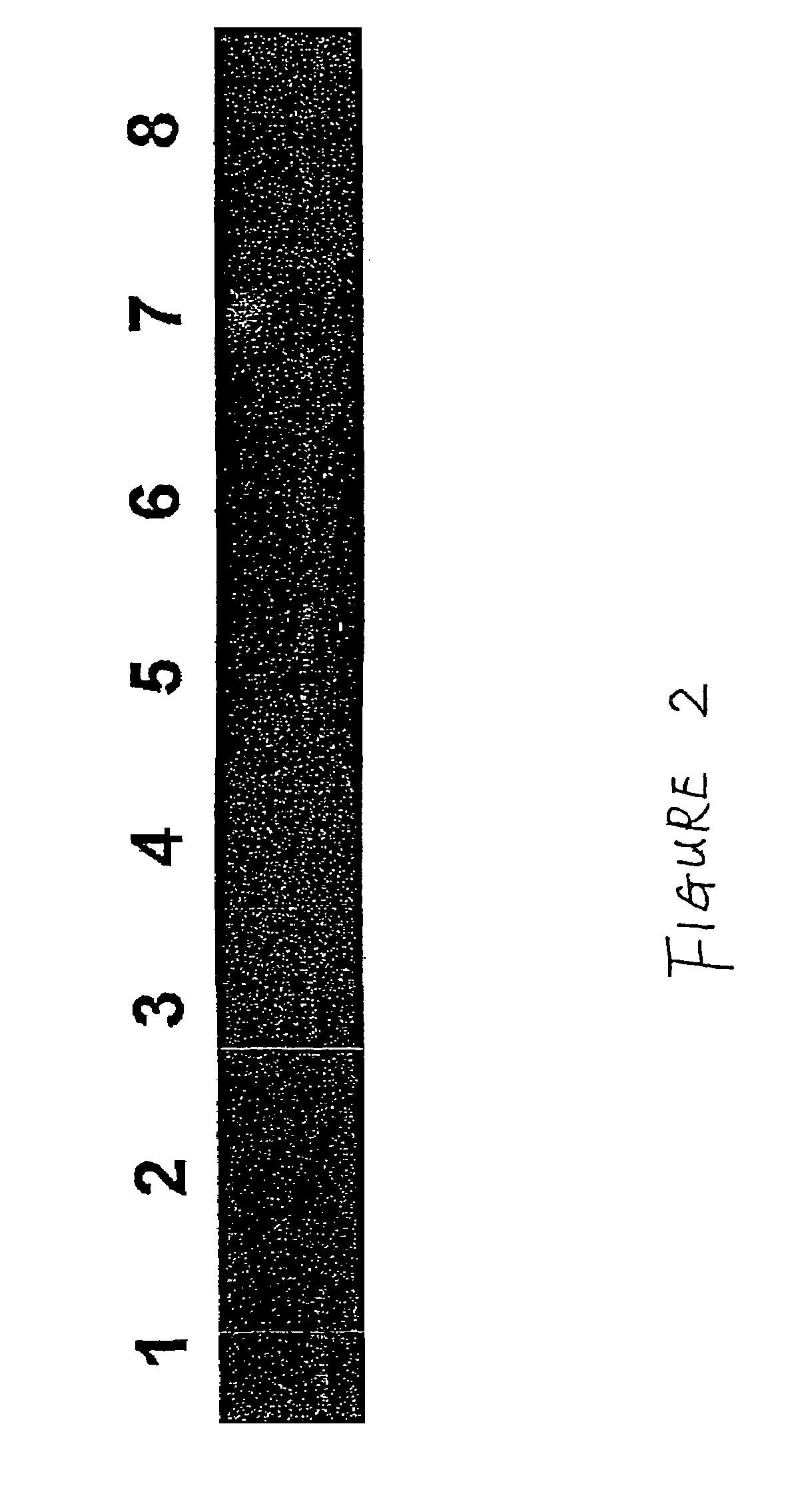 Method for the detection of Chagas disease related gene transcripts in blood