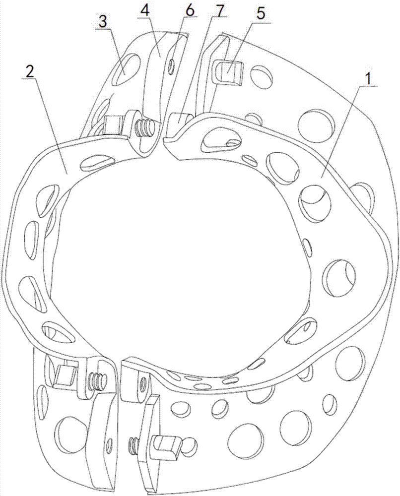 Freely detachable personalized neck brace based on 3D printing and preparation method thereof