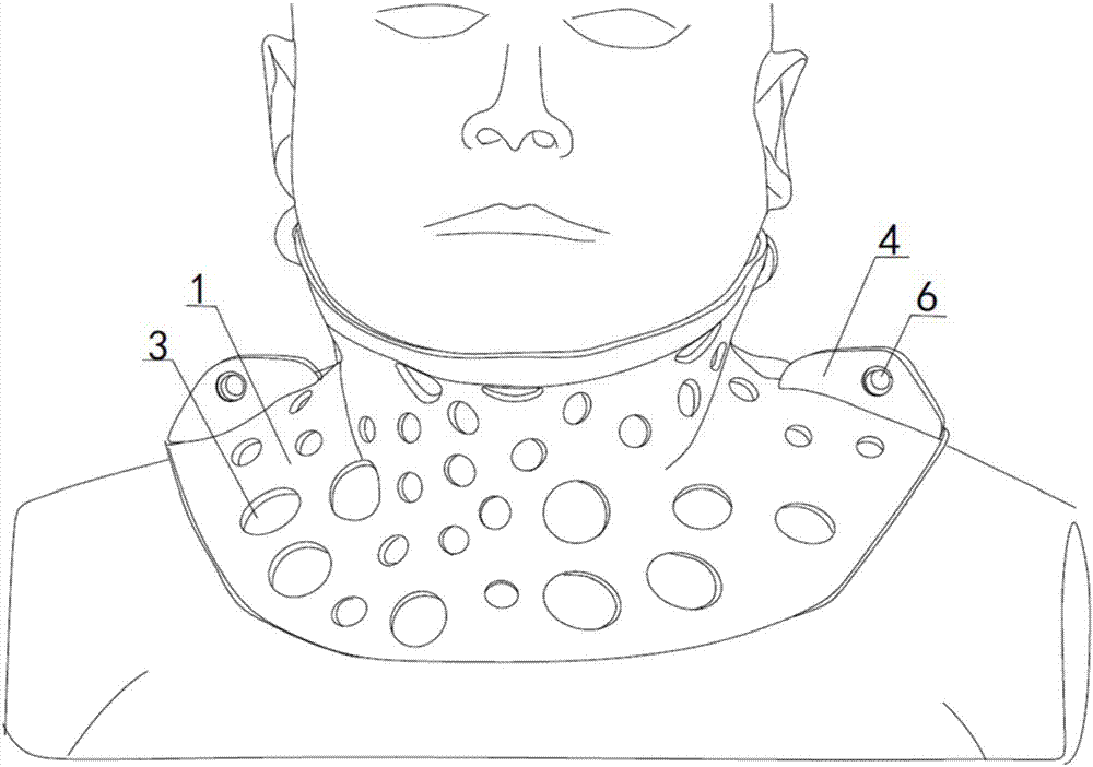 Freely detachable personalized neck brace based on 3D printing and preparation method thereof