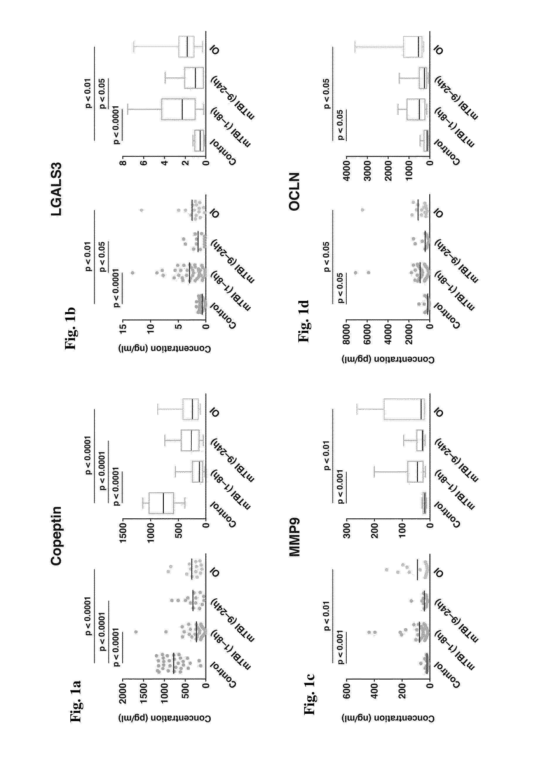 Methods for Diagnosis and Treatment of Concussion or Brain Injury
