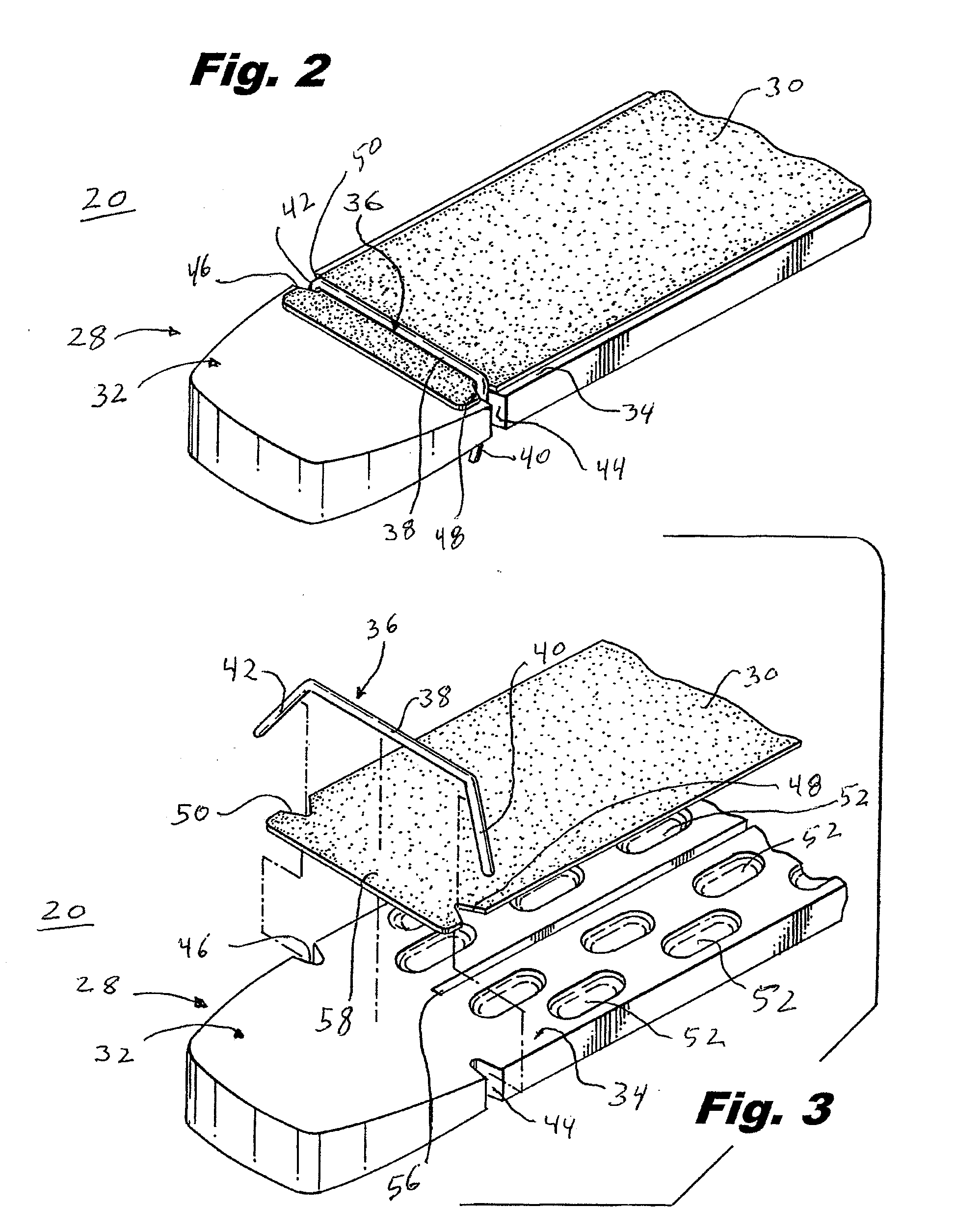 Crimp And Release Of Suture Holding Buttress Material