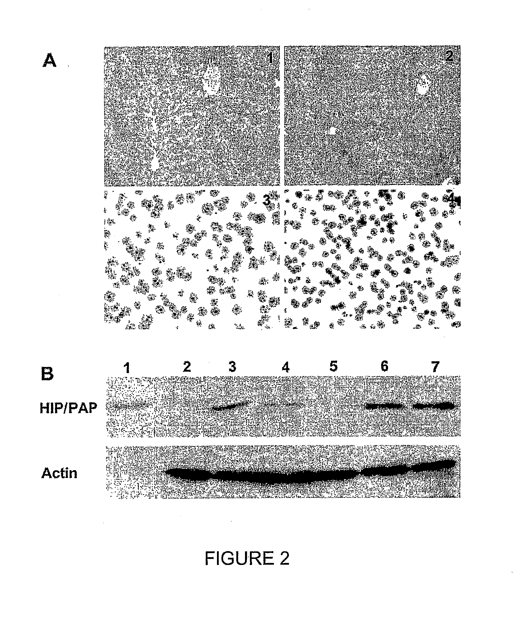 HIP/PAP Polypeptide Composition for Use in Liver Regeneration and for the Prevention of Liver Failure