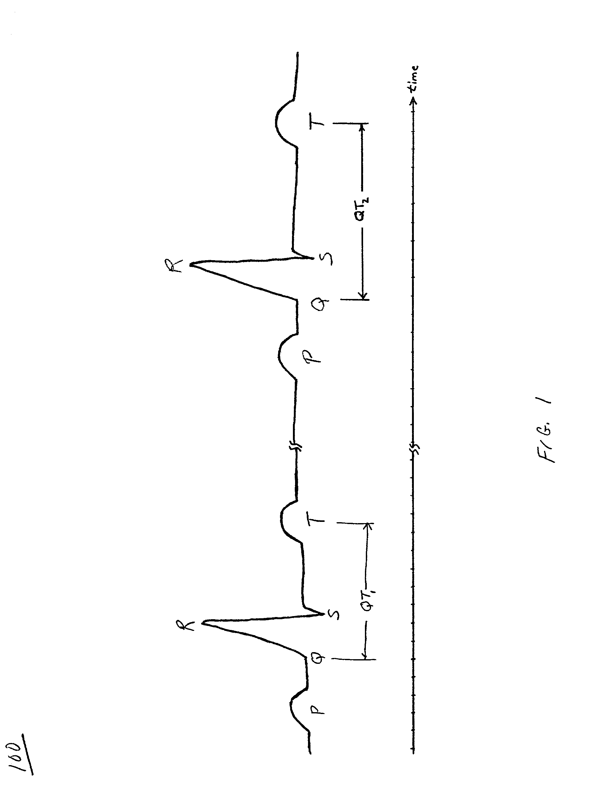 Method and system for terminating an atrial arrhythmia