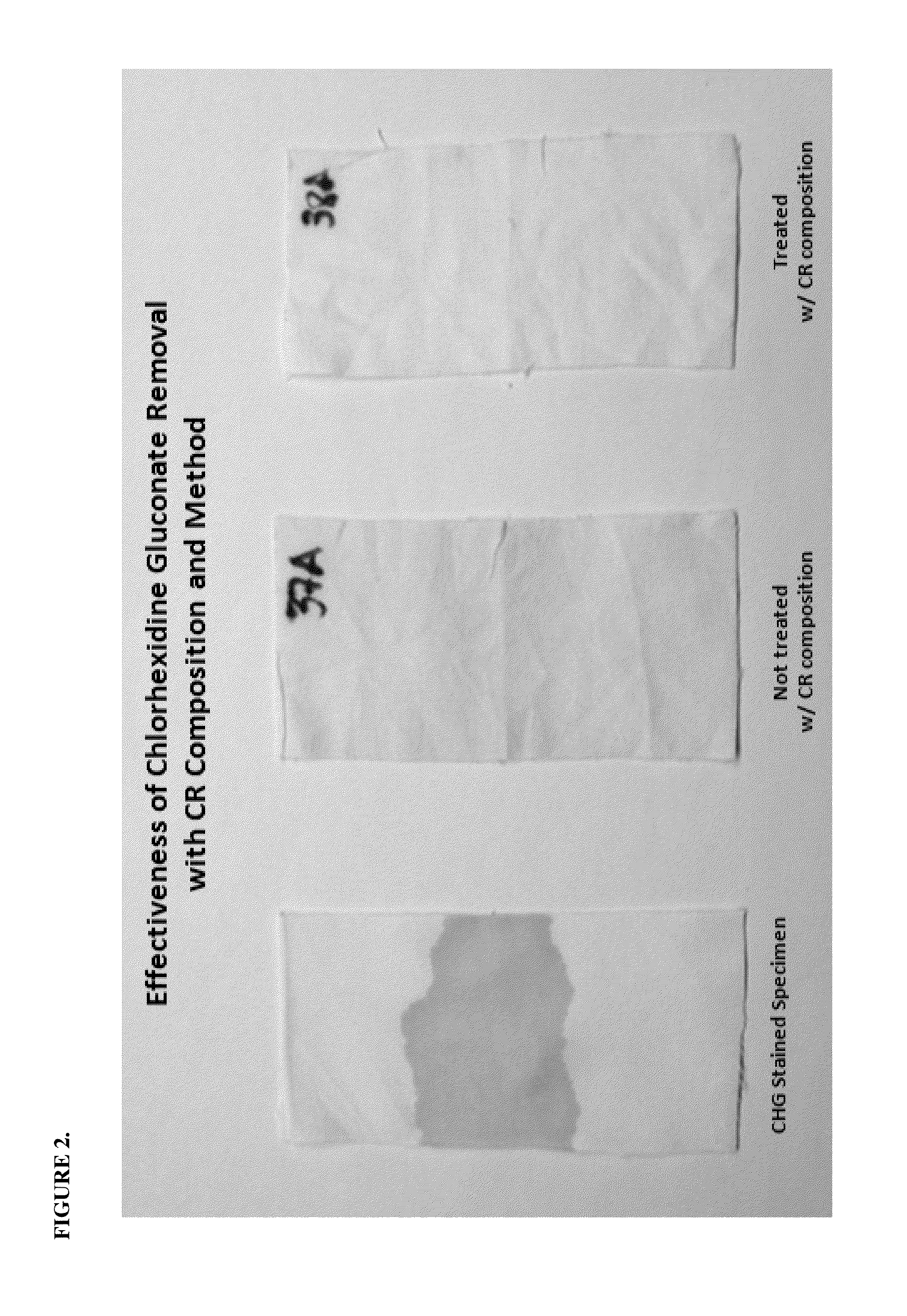 Composition and method for removing stains derived from chlorhexidine gluconate