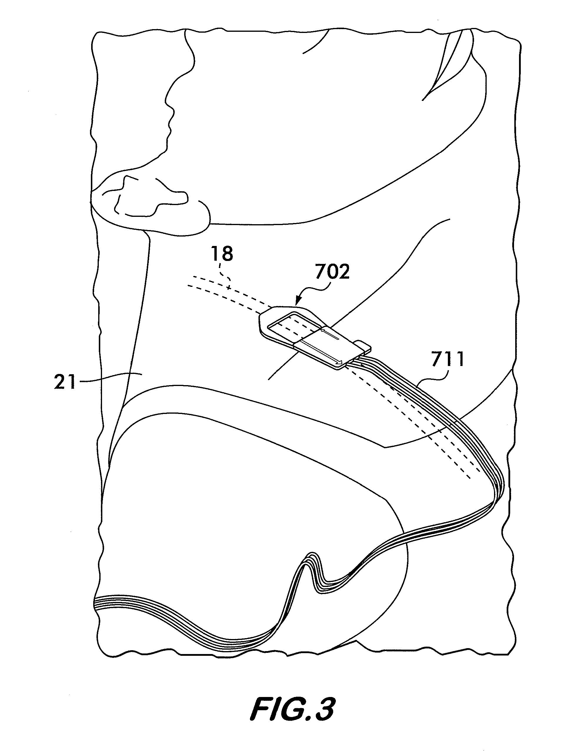 Cerebrospinal fluid evaluation system having thermal flow and flow rate measurement pad using a plurality of control sensors