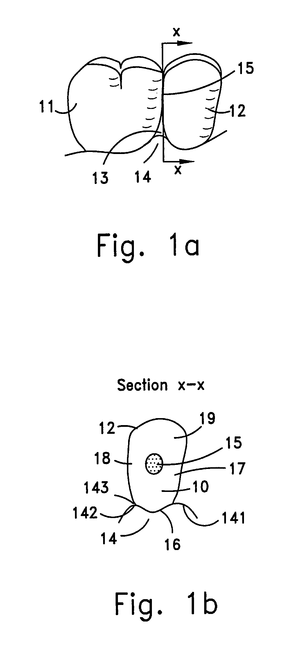 Reshapable device for fixation at a dental site