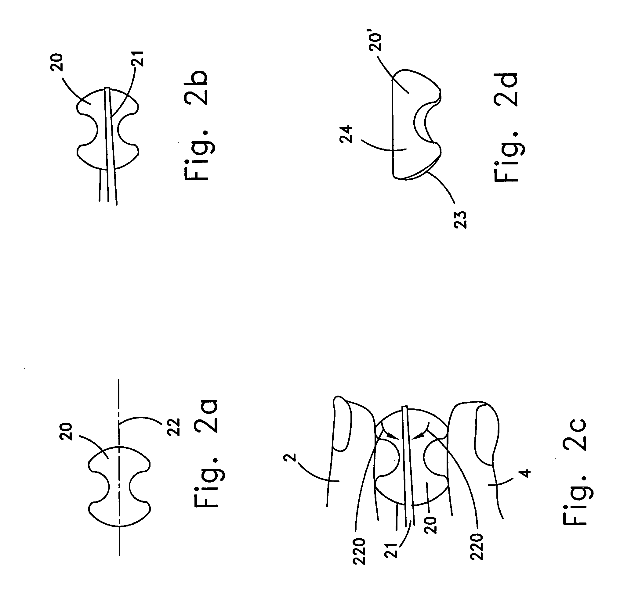 Reshapable device for fixation at a dental site