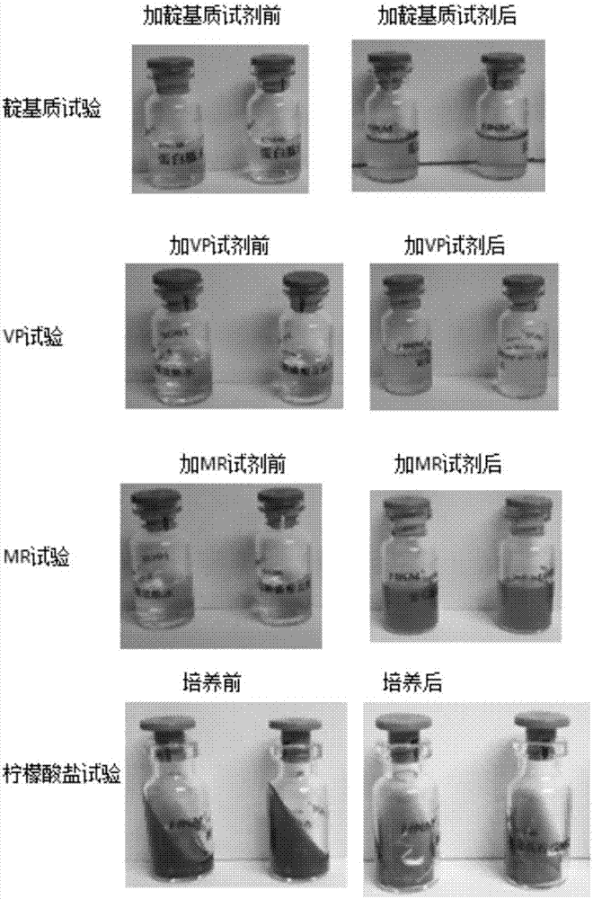 Storage method of transgenic streptococcus suis serotype MRP engineered microorganisms