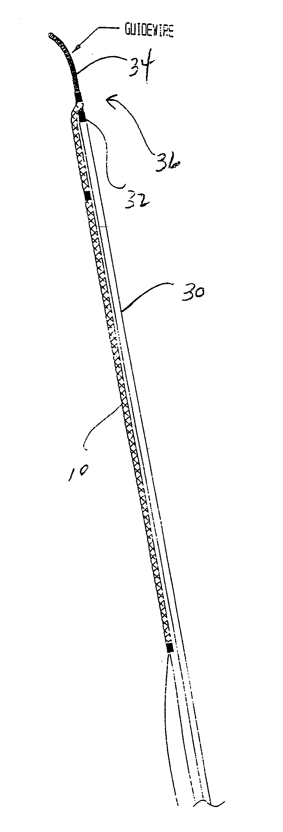 Stent delivery system and method