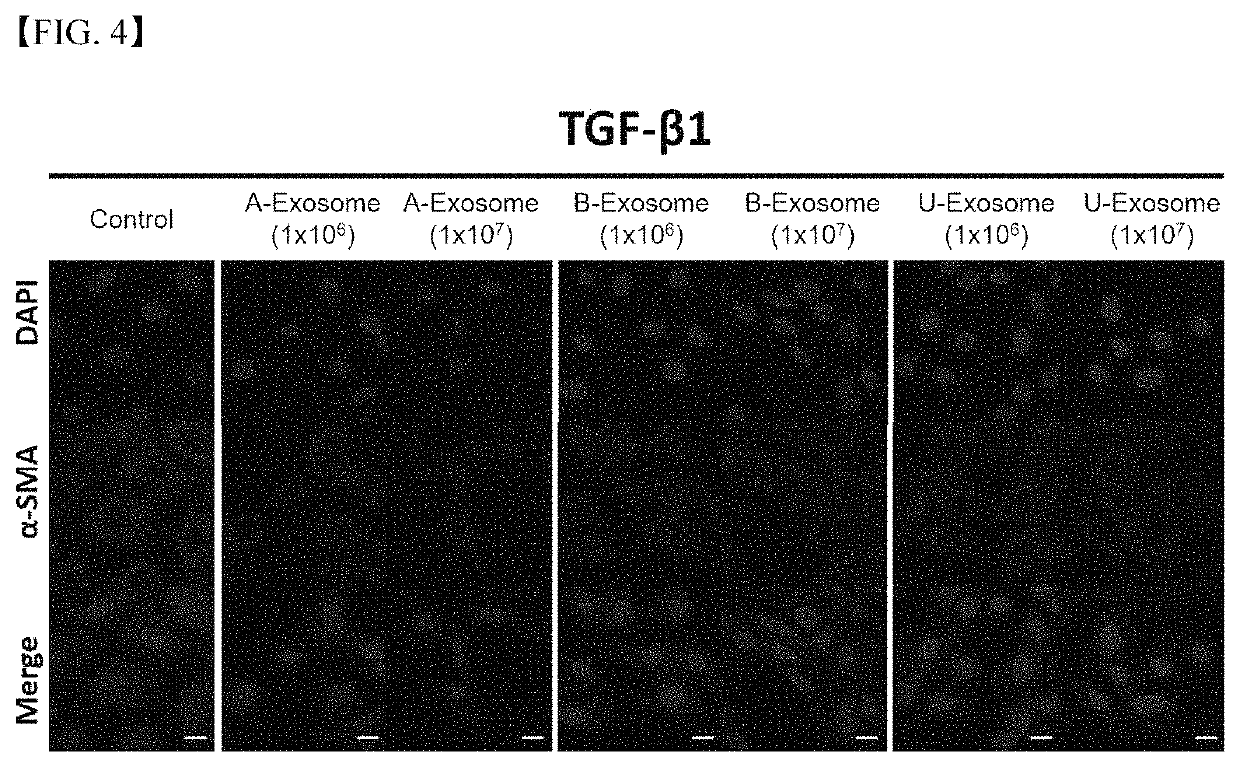 Treating liver fibrosis using adipose stem cell-derived exosomes as active ingredient