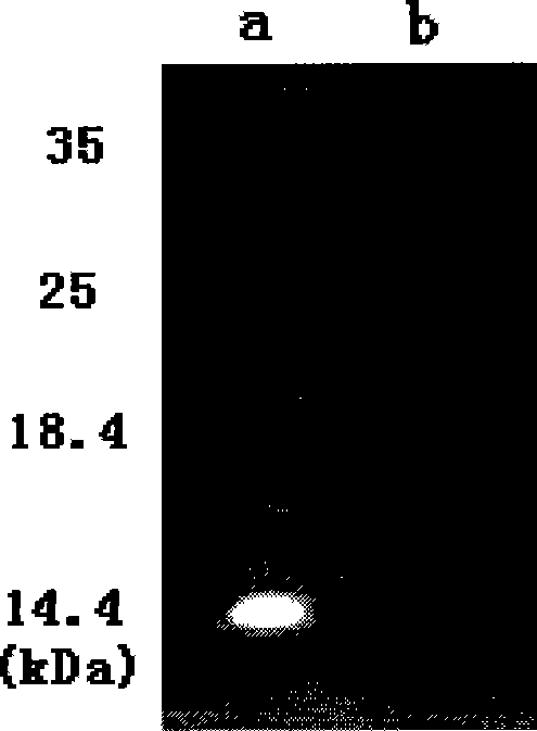 Macrobracium rosenbergii spermatozoon gelatinases, encoding gene and application thereof