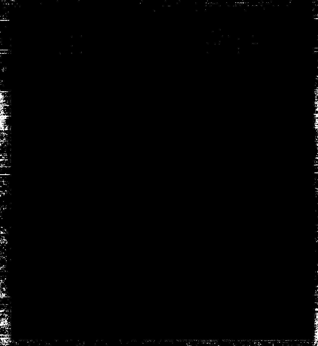 Rapid diagnosis method for plesimonas shigelloides