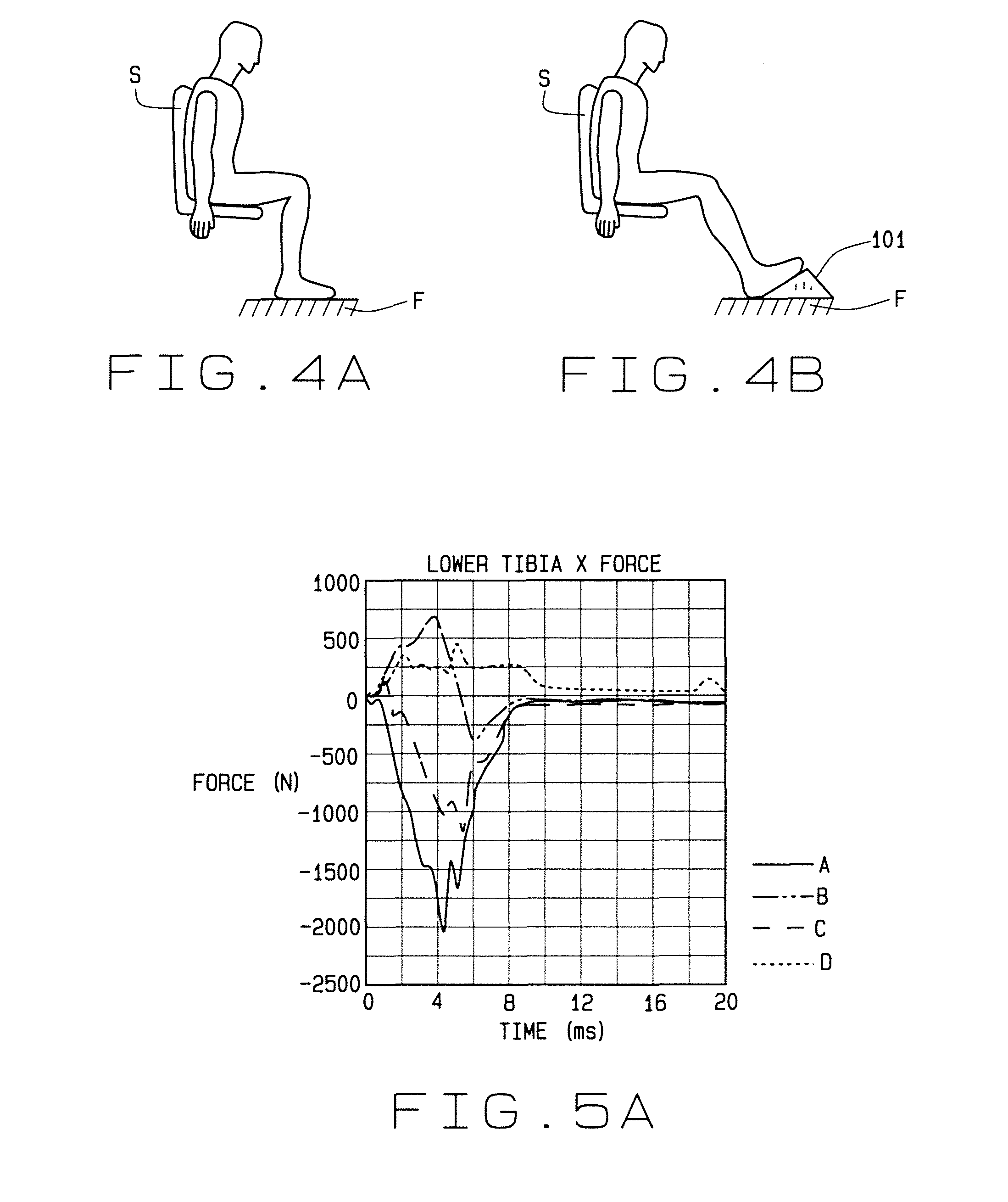 Tibia force reduction wedge