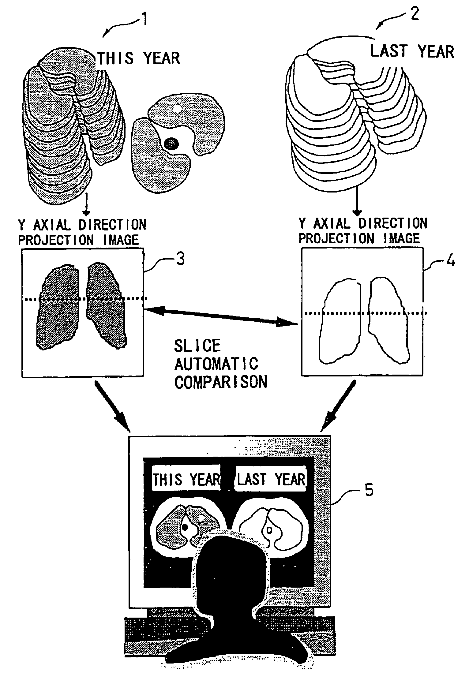 Tomographic image reading method, automatic alignment method, apparatus and computer readable medium