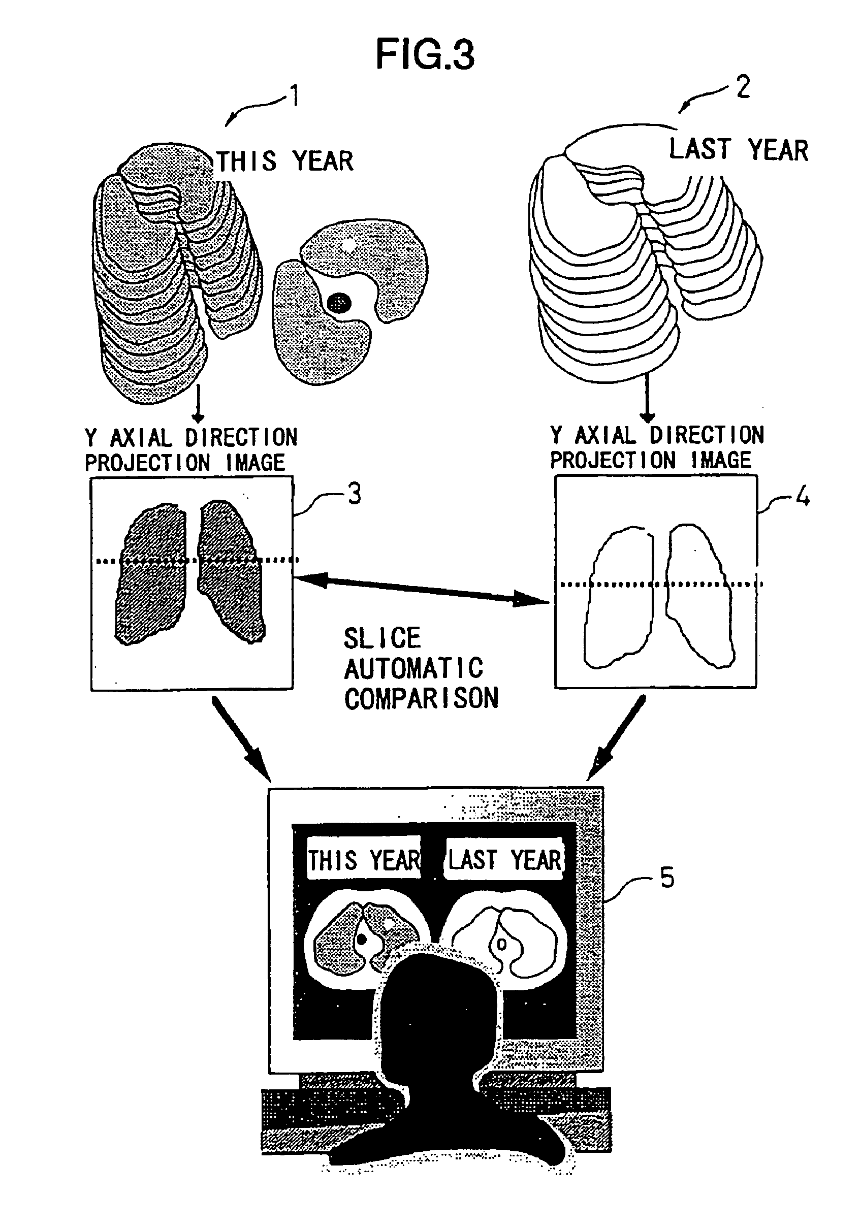 Tomographic image reading method, automatic alignment method, apparatus and computer readable medium