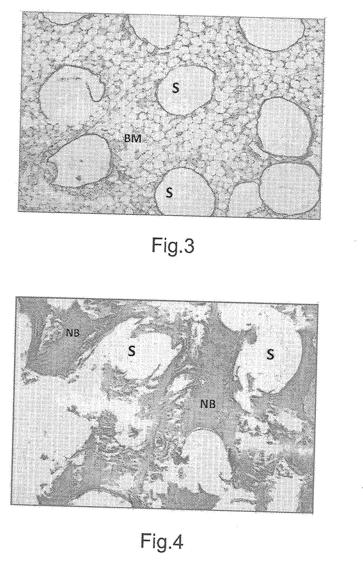 Method for manufacturing bone implants and bone implant