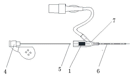 Arteriovenous indwelling needle sealing plug