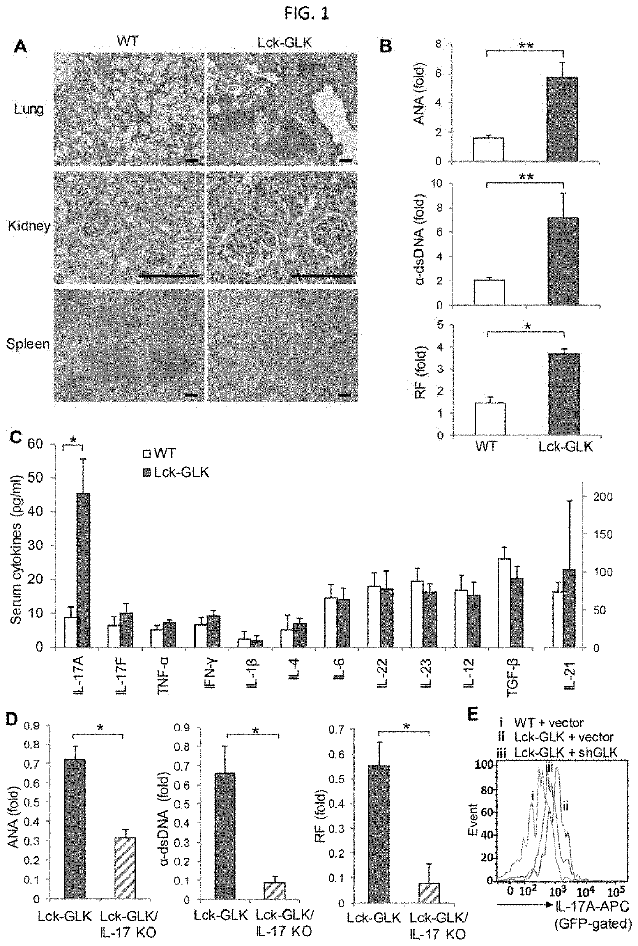 AhR-ROR-γt complex as a biomarker and therapeutic target for autoimmune disease and IL-17A-associated disease