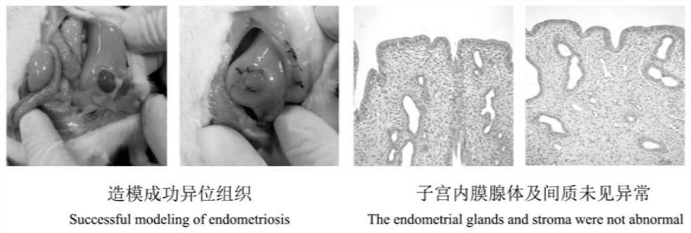 Application of Shixiaosan in preparation of medicine for treating endometriosis pain symptom