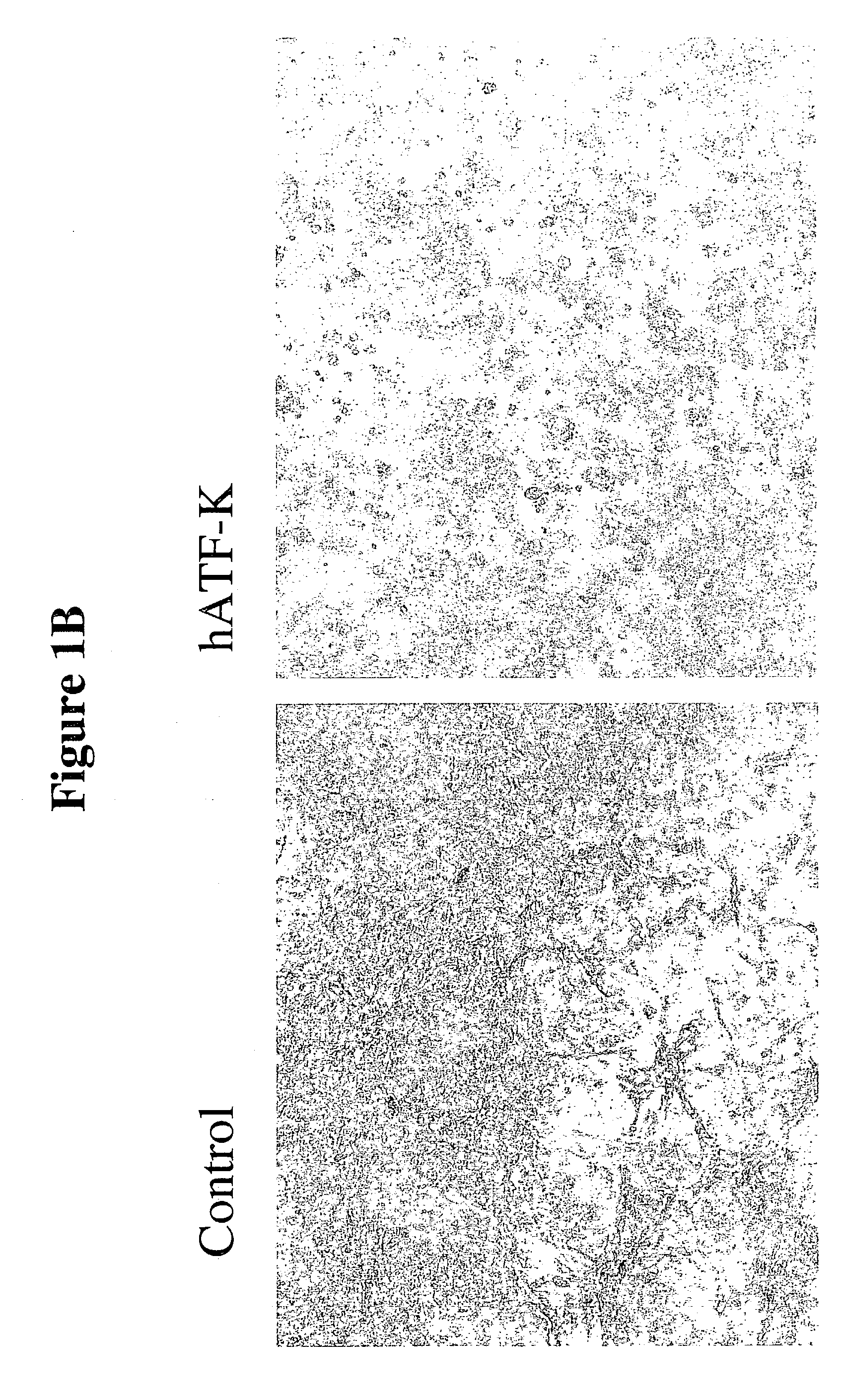 Kringle polypeptides and methods for using them to inhibit angiogenesis