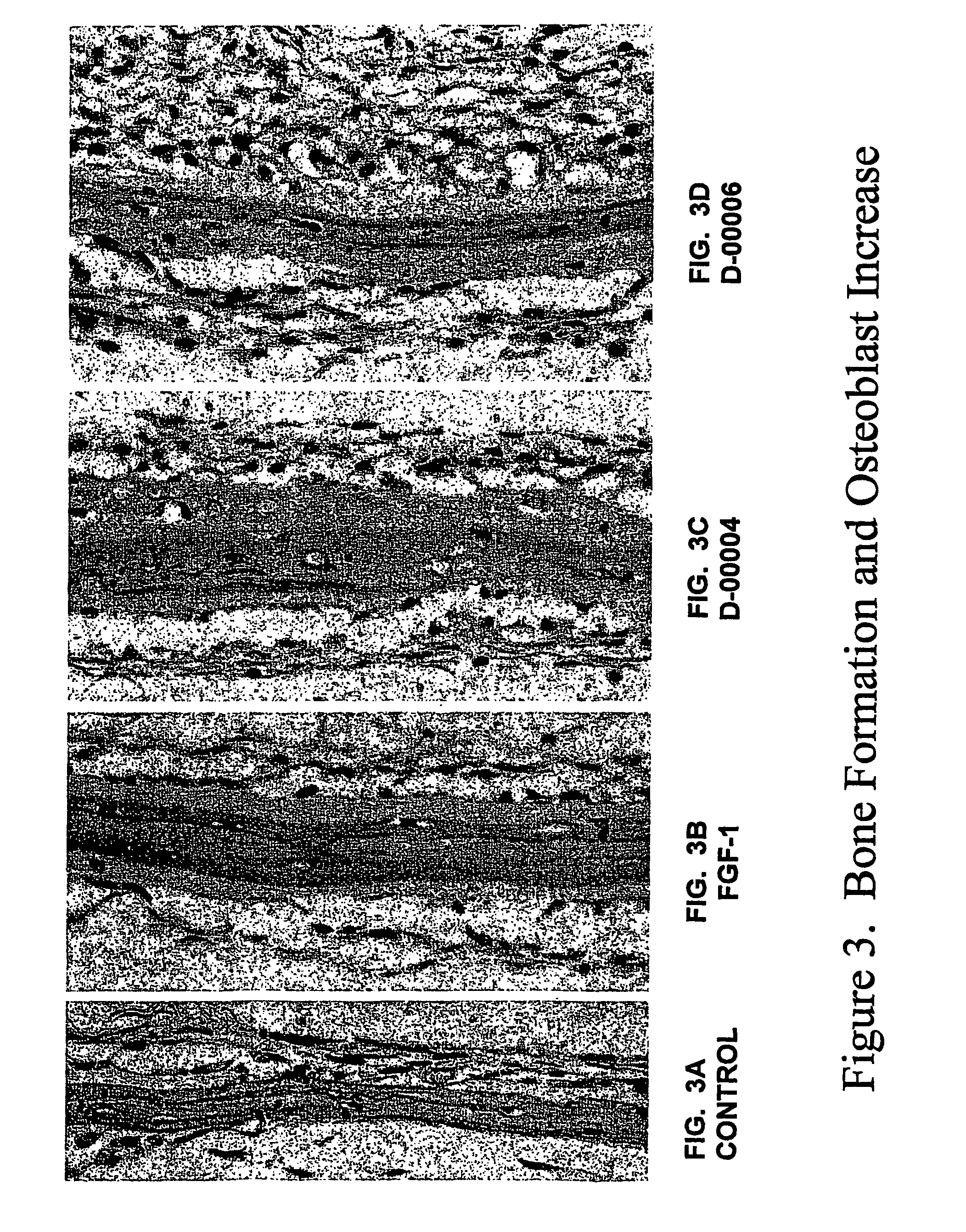Dental products comprising bone growth enhancing peptide