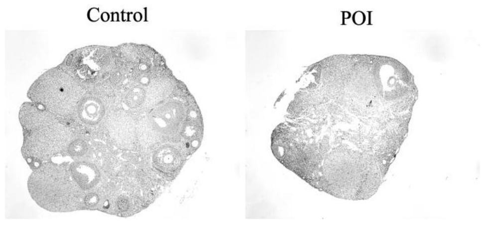 Application of fat active protein in preparation of medicine for treating premature ovarian insufficiency