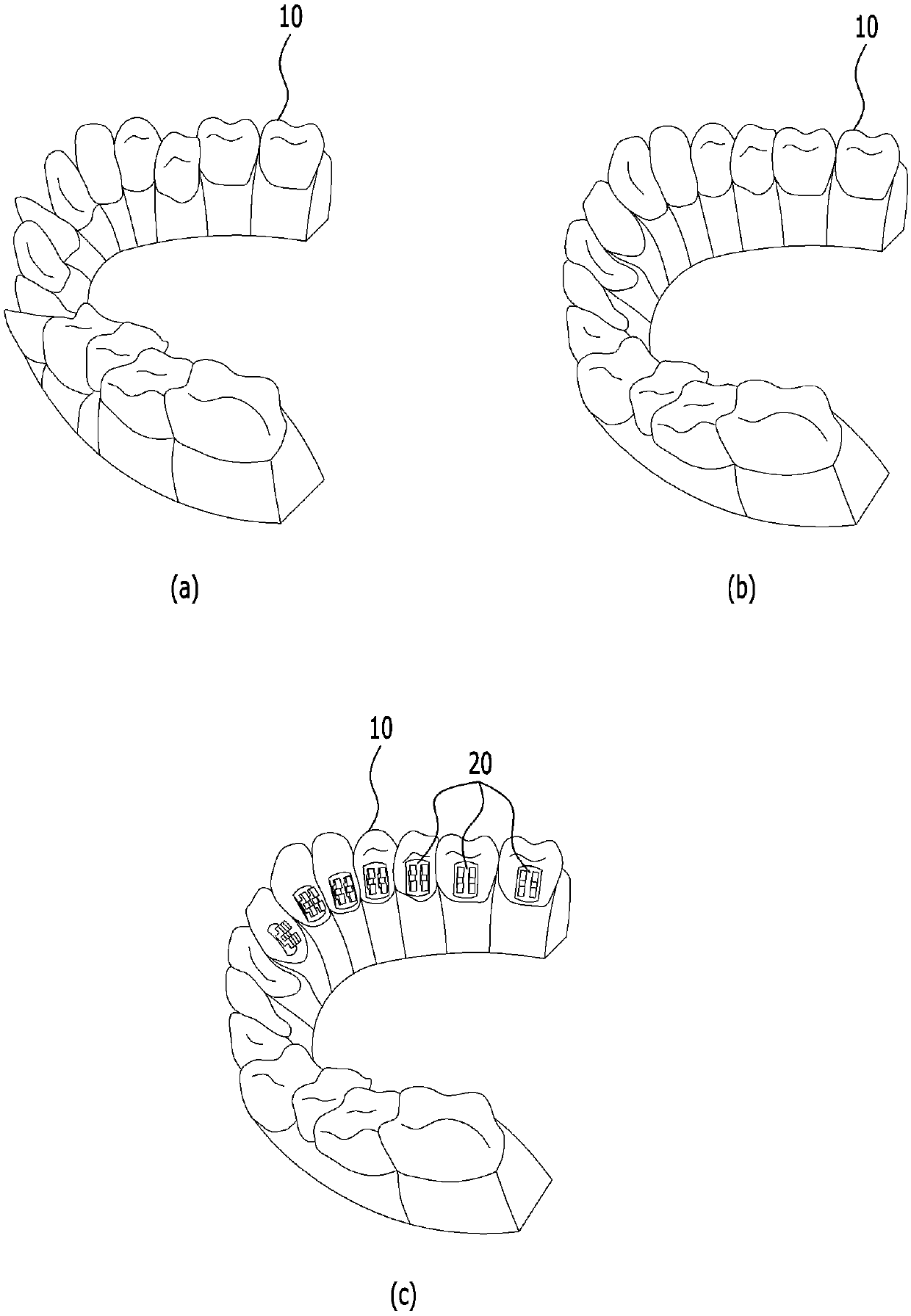 Method for manufacturing customized orthodontic square wire