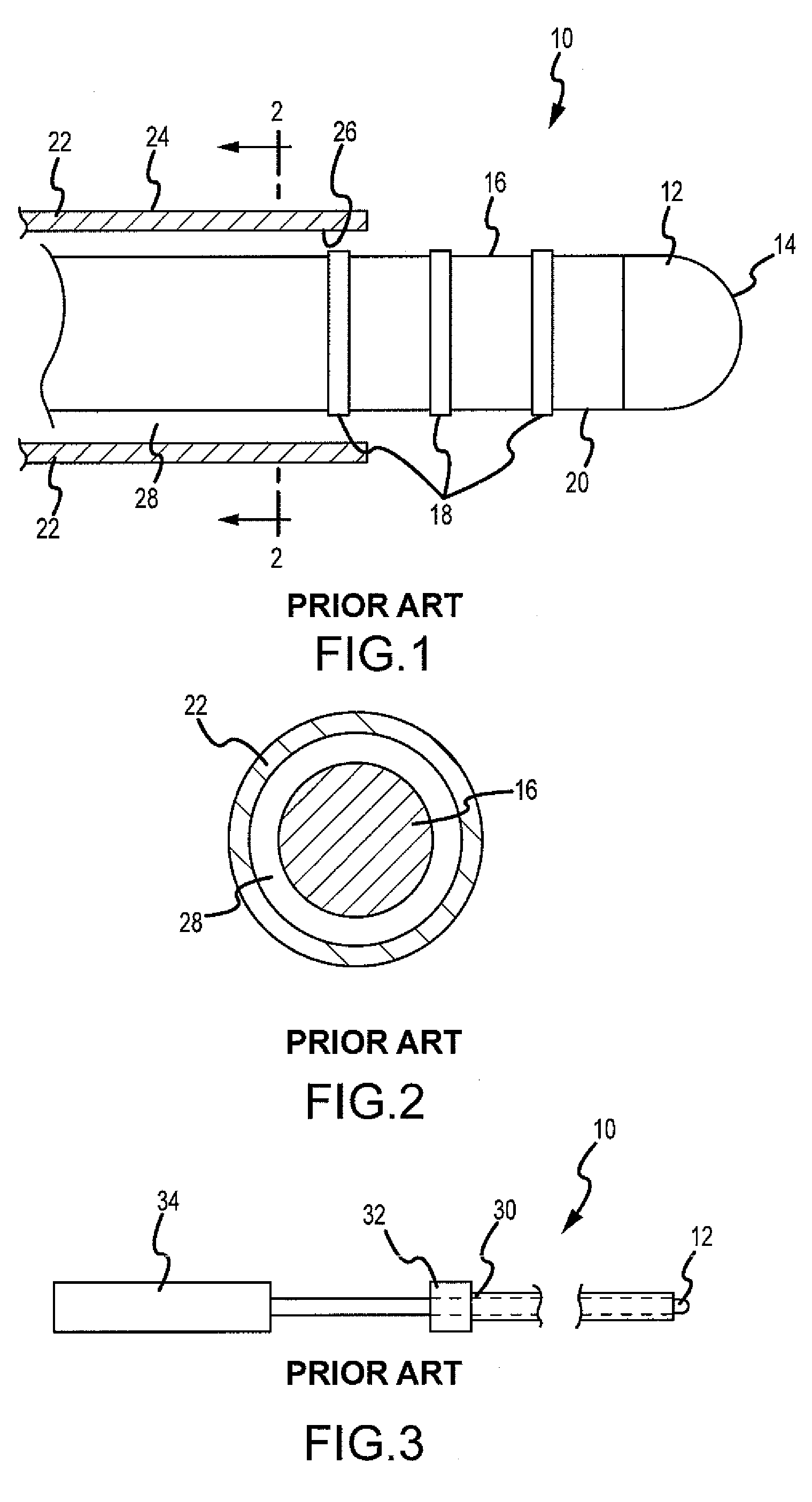 Catheter assembly with front-loaded tip