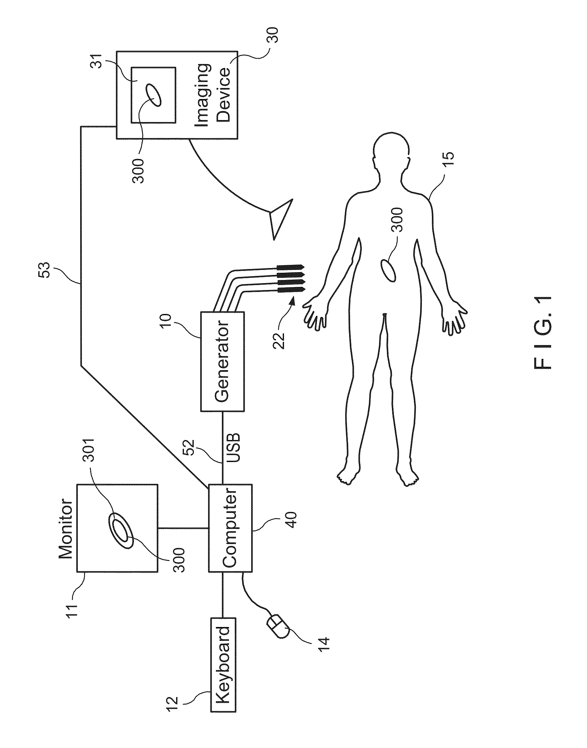 System and method for increasing a target zone for electrical ablation