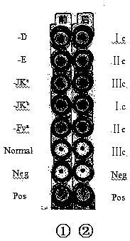 Sorting type RBC (Red Blood Cell) blood type irregular antibody detection kit based on solid phase agglutination technology and preparation method thereof