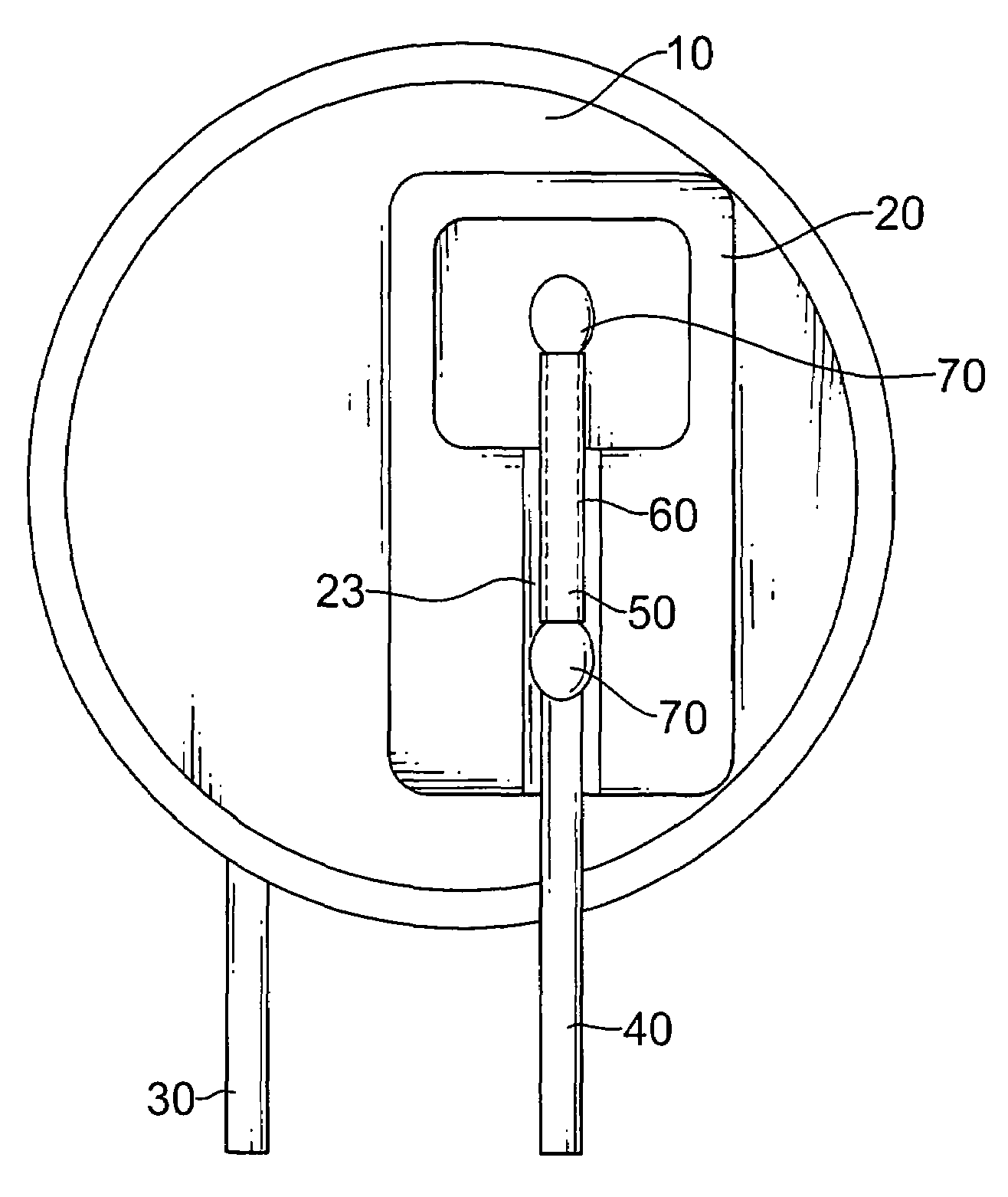Metal oxide varistor with a heat protection