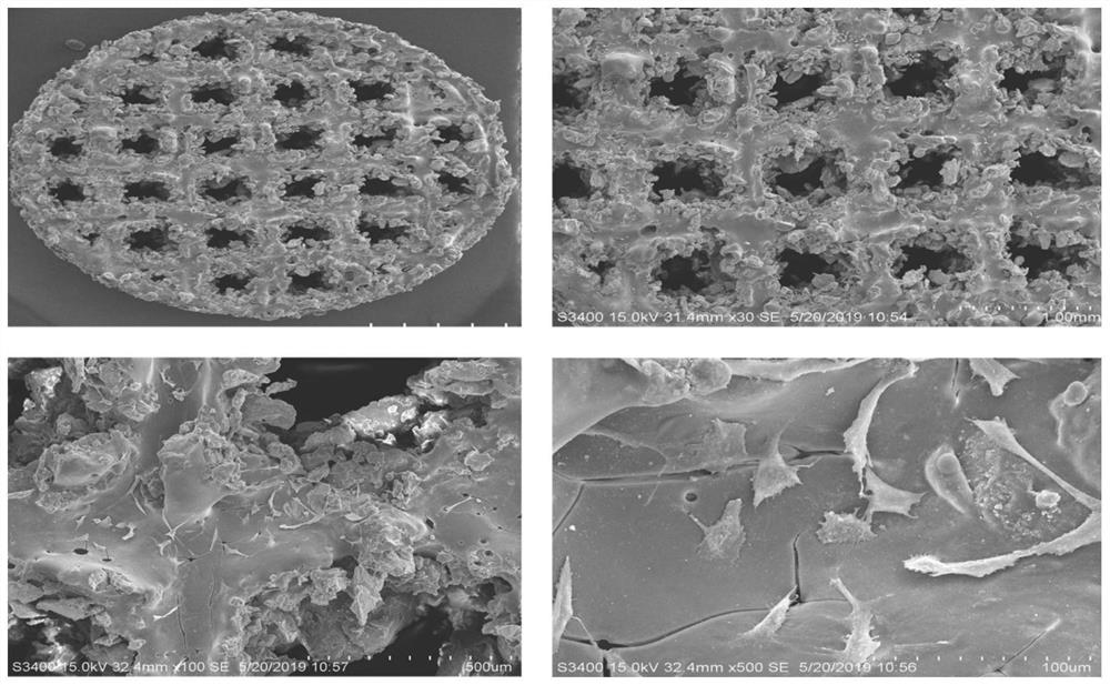 A kind of artificial bone for repairing tumor bone defect and preparation method thereof