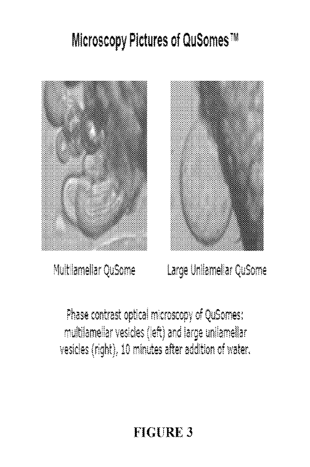 Liposome formulations