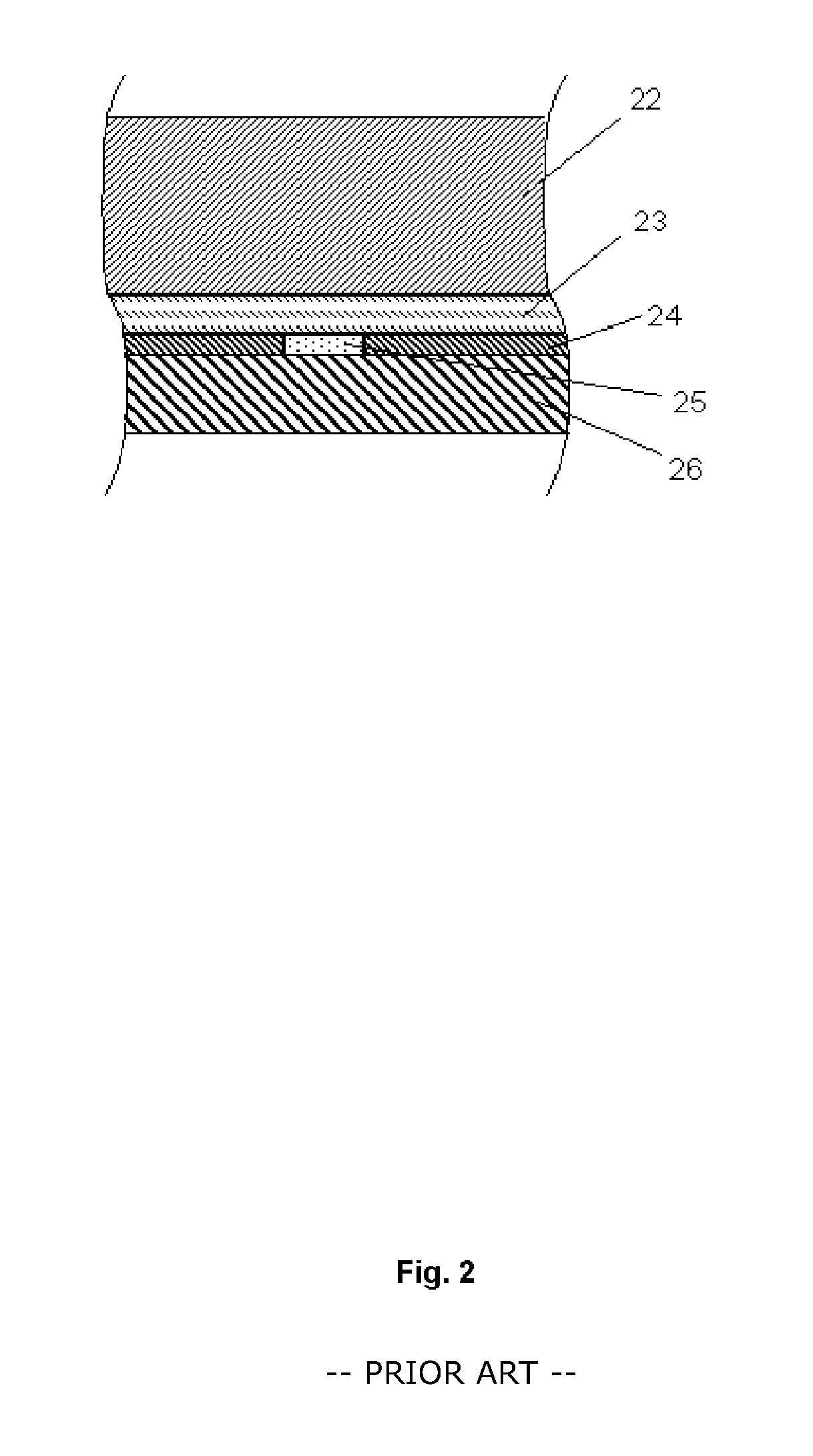 Enzyme sensor with a cover membrane layer covered by a hydrophilic polymer