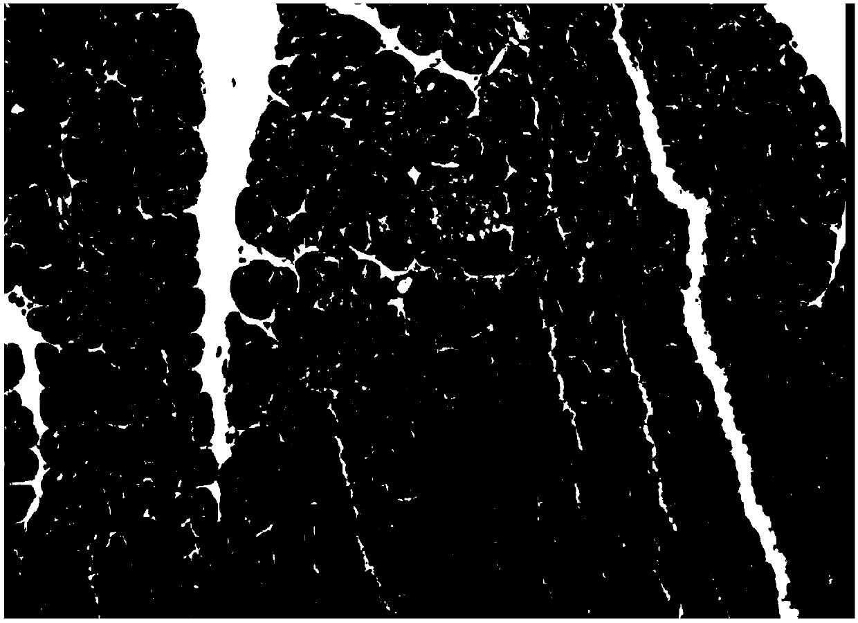 Application of pyrazolopyrimidine derivative for treating liver injury caused by acute pancreatitis