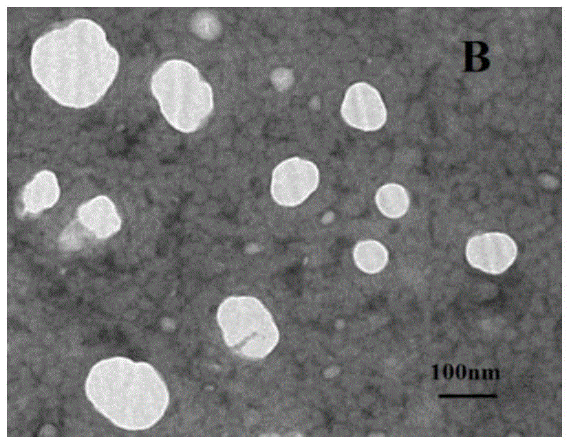 H102 peptide nasal liposome-type spray