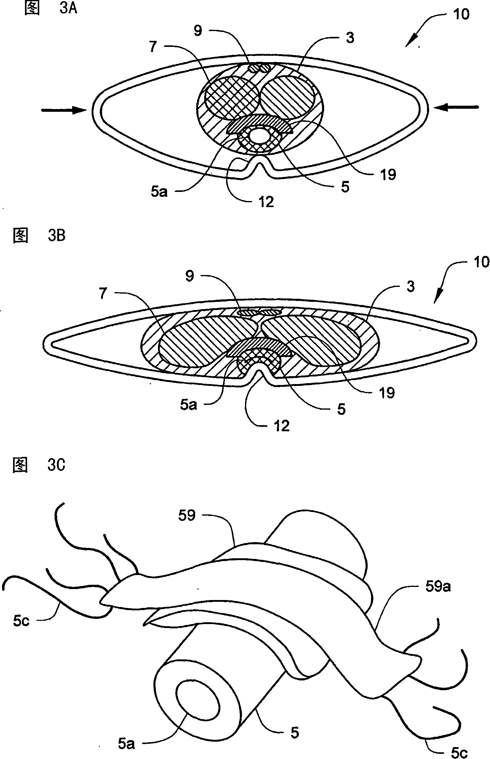 Penile compression device
