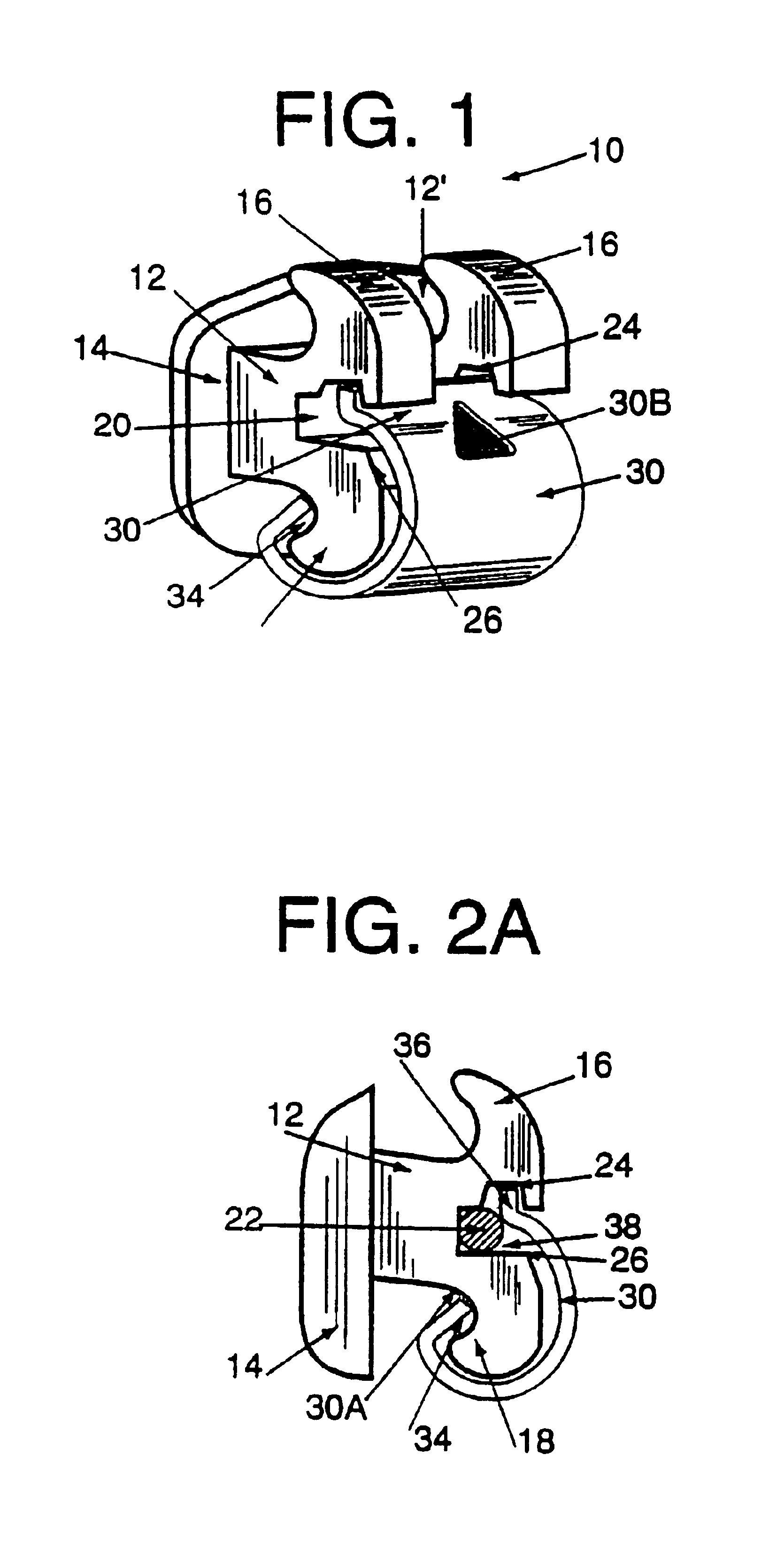 Orthodontic bracket