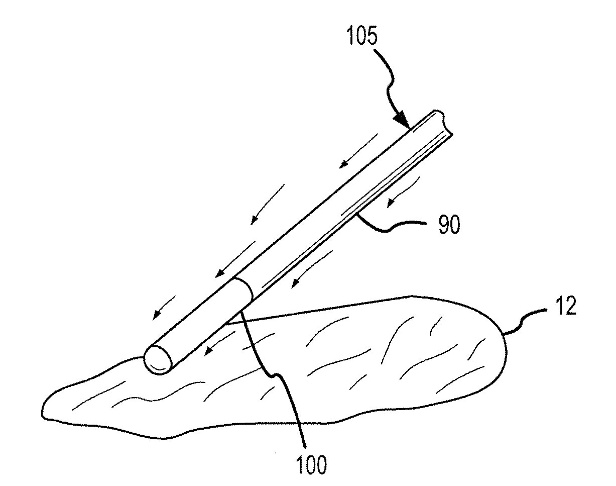 Flexible Conductive Polymer Electrode and Method for Ablation