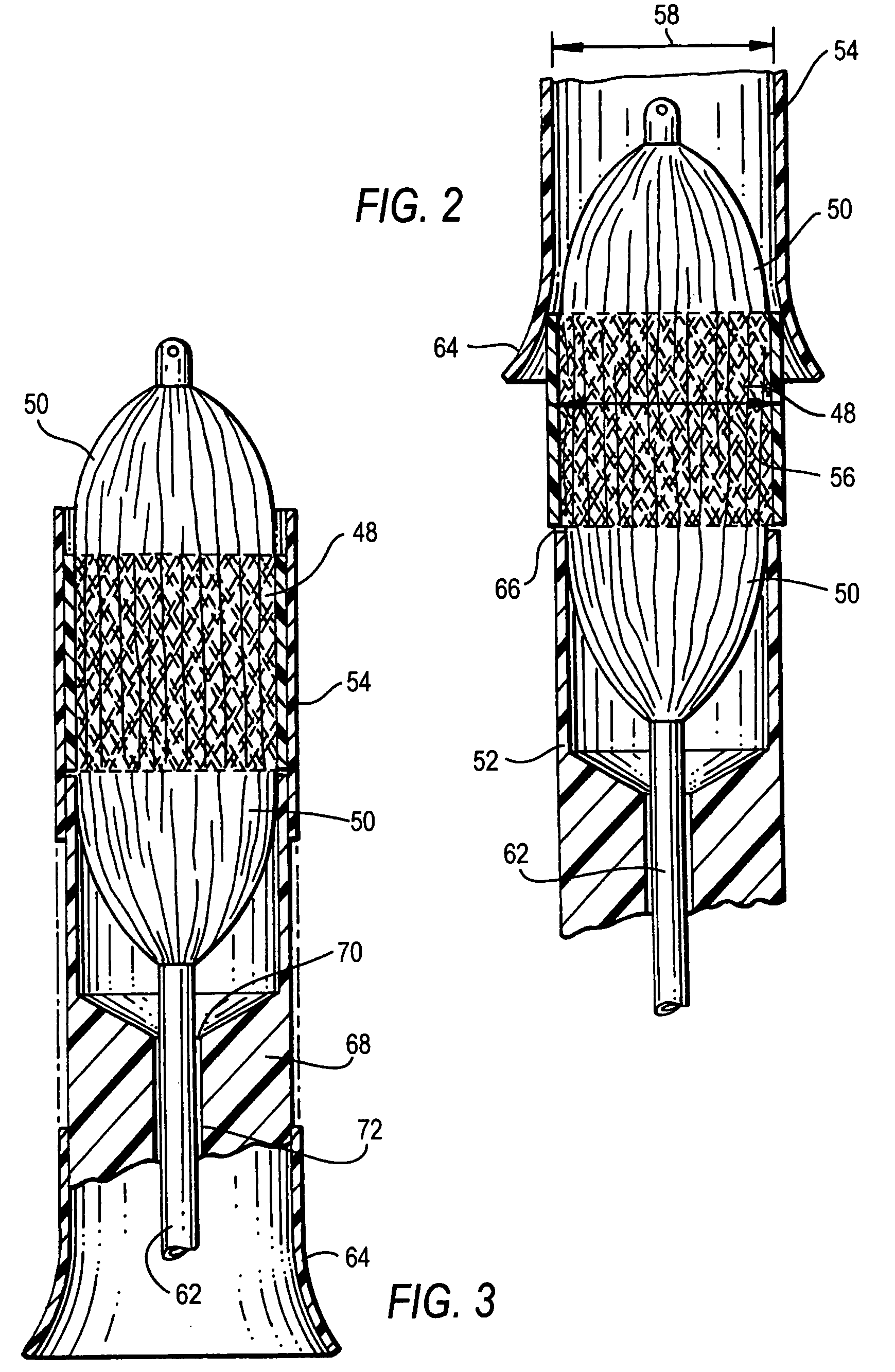 Device and method for assisting in the implantation of a prosthetic valve