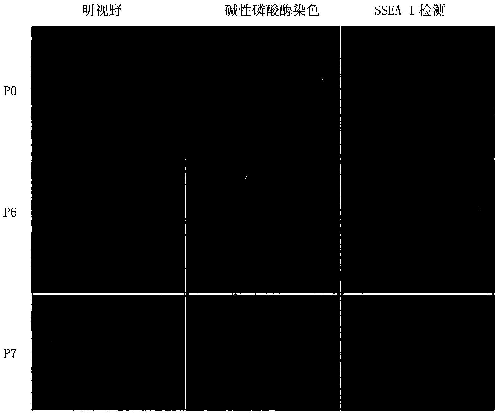 Embryonic stem cell culture medium and application thereof