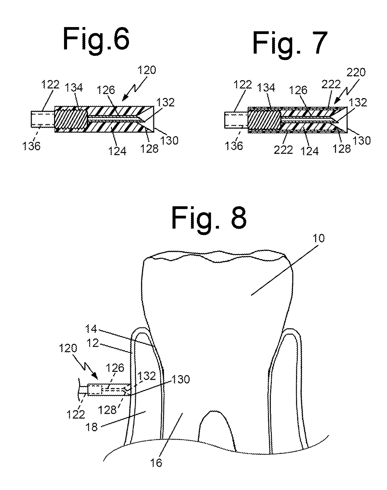 Anesthesia applicators/injectors for dental and other applications and methods of use
