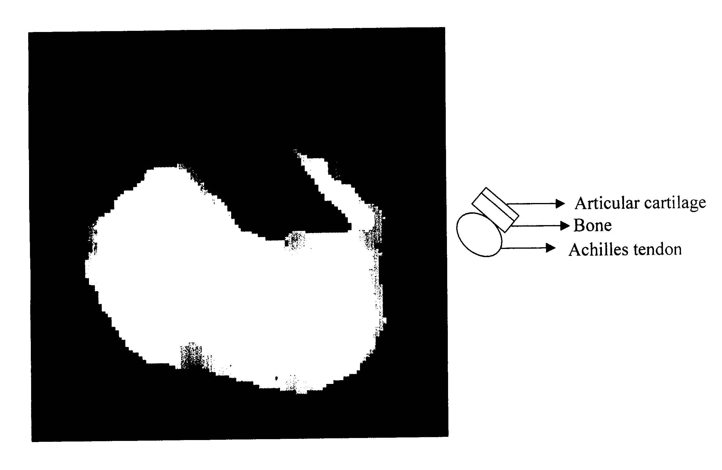 Method of selective excitation for improving contrast in magnetic resonance imaging