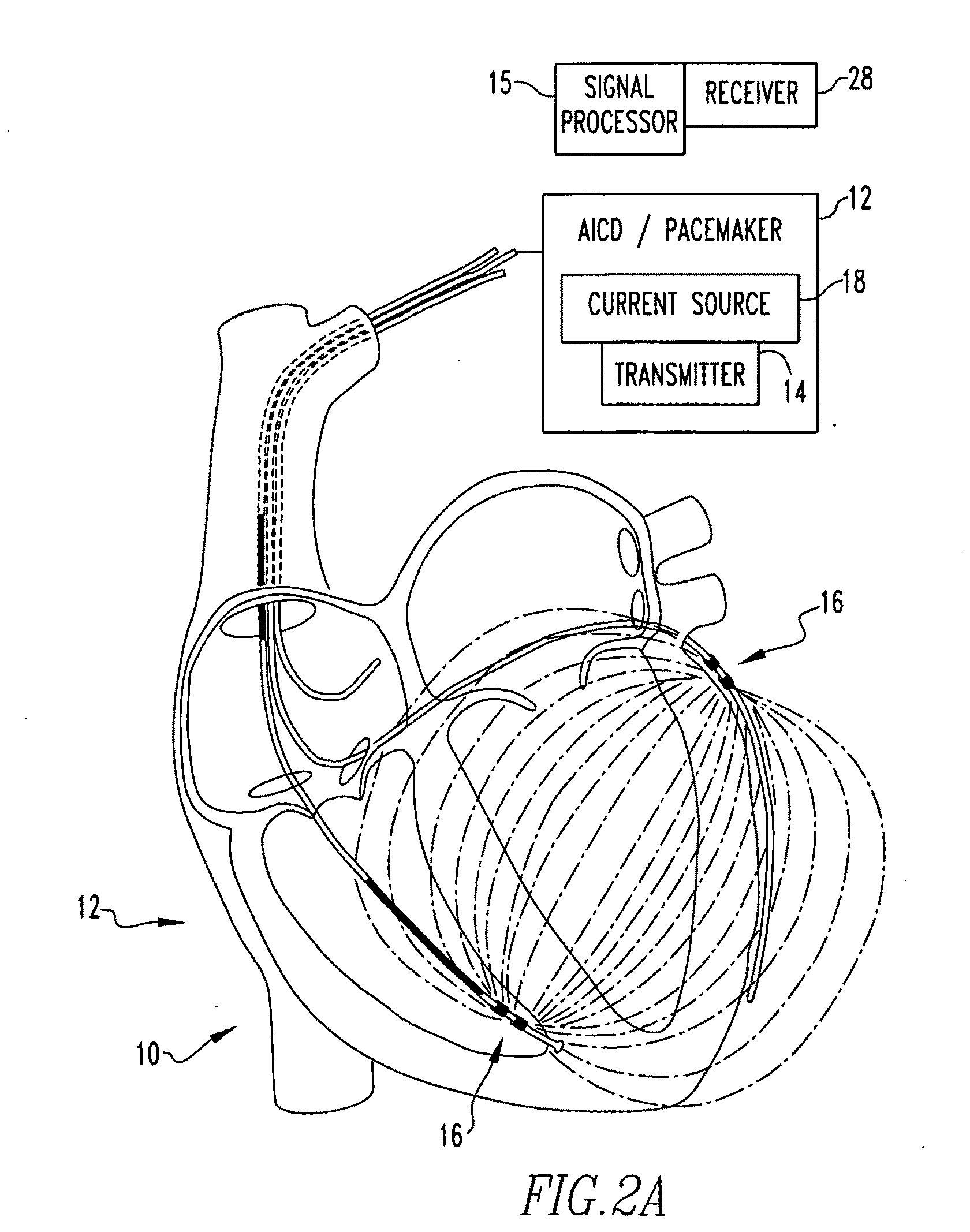 Method and apparatus for monitoring an organ of a patient