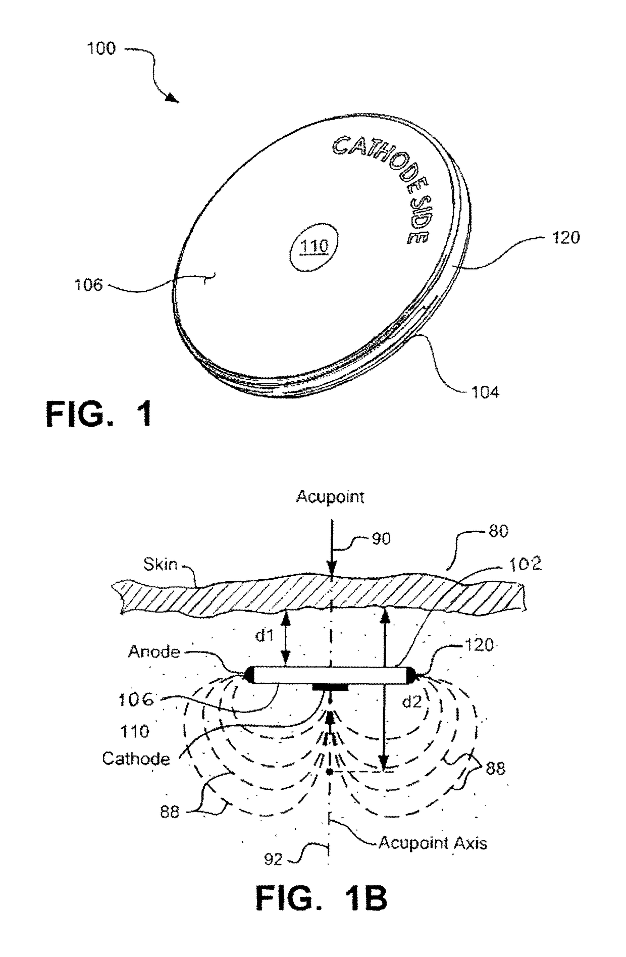 Implantable electroacupuncture device and method for treating erectile dysfunction