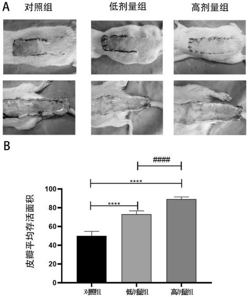 Effect of catalpol in preparation of medicine for promoting survival of ischemic super-long random skin flap
